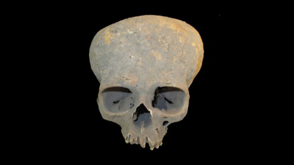 skull from Chichester